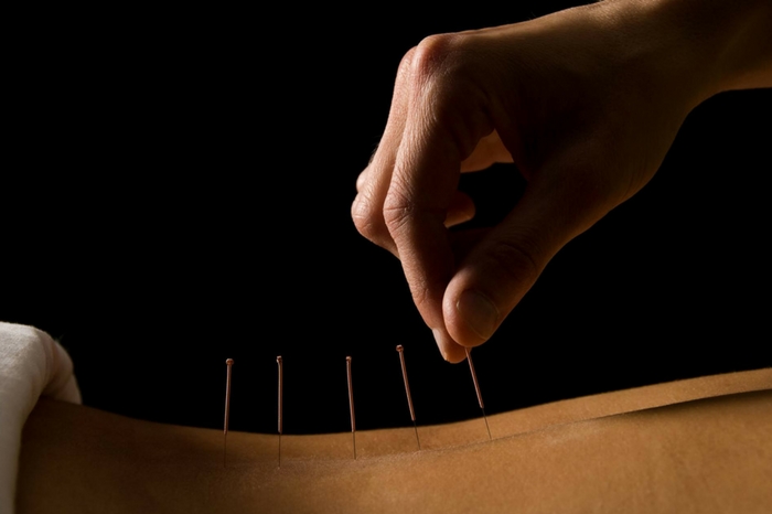 The Top Places for Traditional Chinese Medicine in Hong Kong